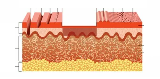 tipi di laser peeling